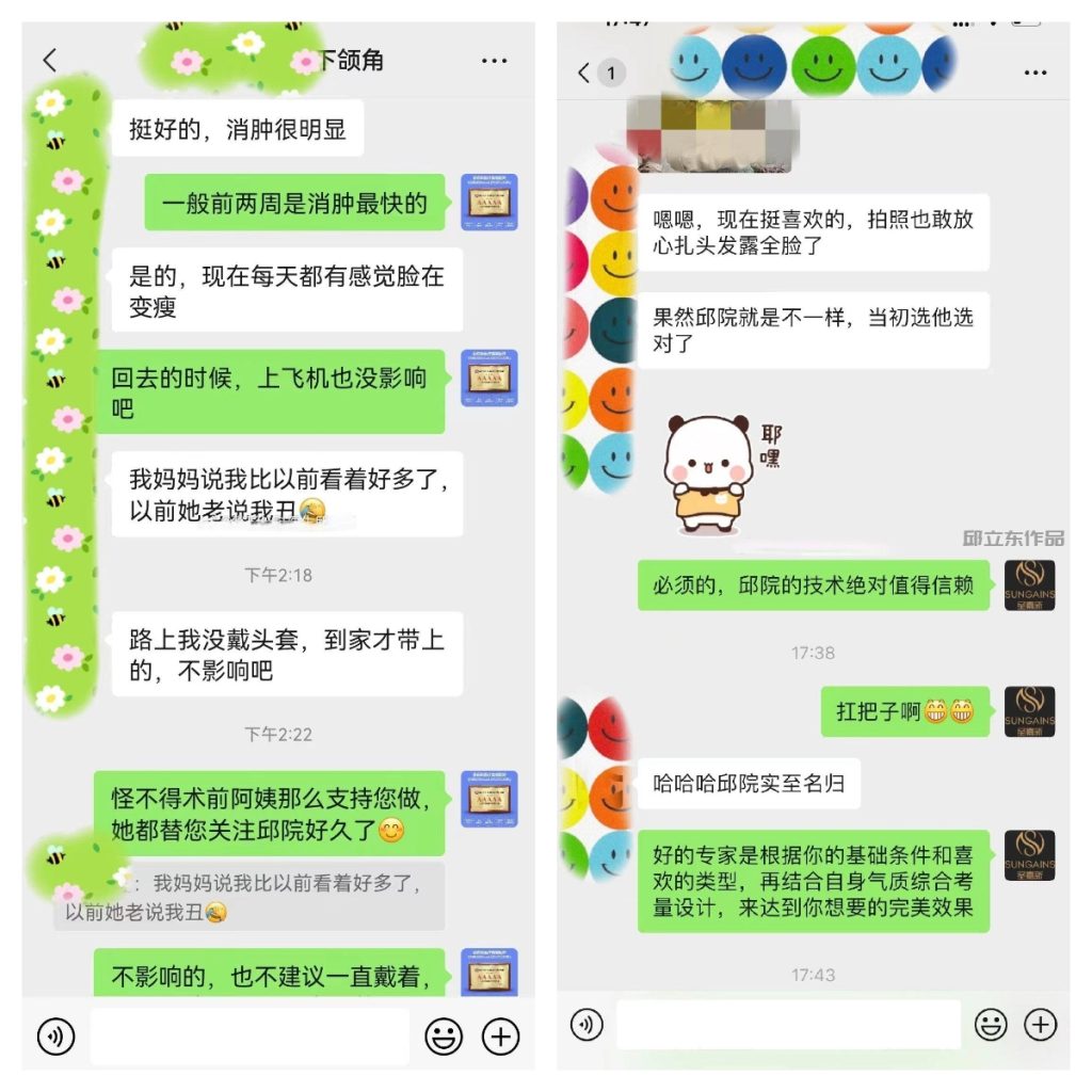 北京邱立东磨骨改脸型手术怎么样？